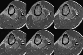特殊病种患者注意！门诊CT/MRI检查可享‘双倍报销比例’福利图片