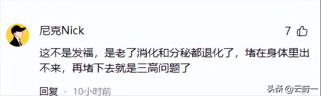 59岁王志文新照流出，肚腩突出耳朵异常，网友猜测患有心脏类疾病