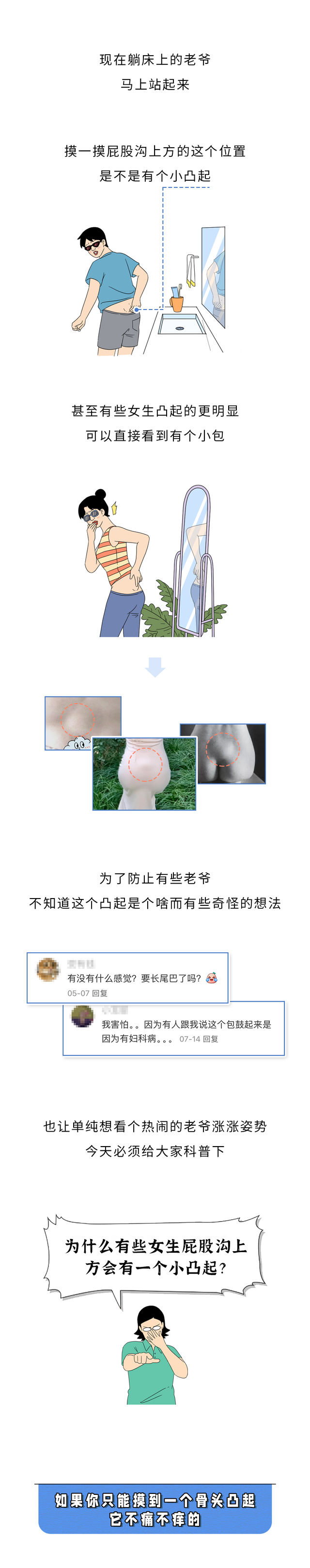 为啥很多女生屁股沟上方，会有个小凸起？