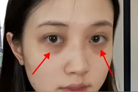 黑眼圈不要轻视图片