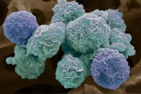 这些癌症居然会传染！请转发扩散！图片