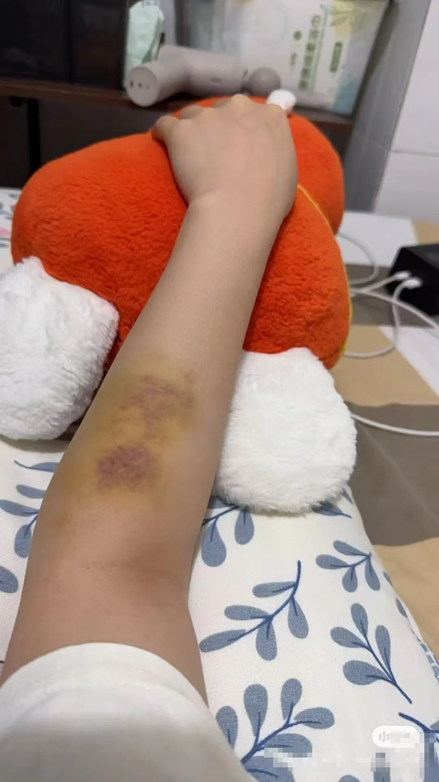 女子深圳面试遭殴打伤情鉴定为轻伤二级，公司前女采购员称遭同一施暴者戳伤并罚款4000元
