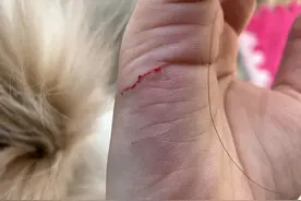 猫抓伤后要不要打狂犬疫苗呢？一般被抓伤了又该如何处理呢？图片