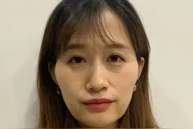 医美是个无底洞，一年一次线雕半年一次玻尿酸，轮廓提升后真后悔图片