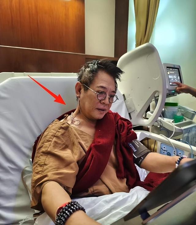 李连杰手术3天后，恶心的一幕发生了，千万保命珠反引来网友群嘲