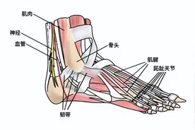 脚踝扭伤后别急着运动！小心一时疏忽变成长久伤痛图片