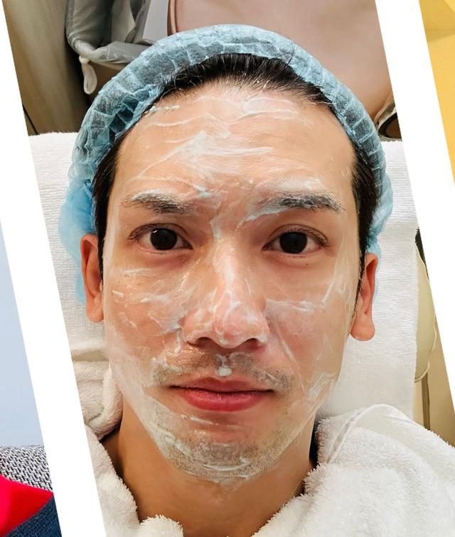 关智斌自曝煤气意外漏气致面部二级烧伤，公开康复期照片惹人心疼