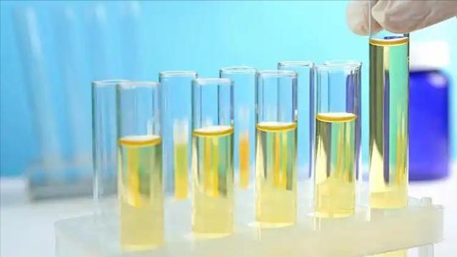 肾结石要戒酒吗？医生提醒：患有肾结石后，饮酒牢记“3不喝”