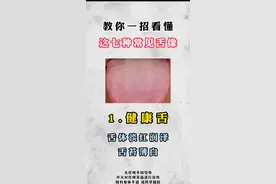 教你一招，看懂7种常见舌象，如果是第一种，恭喜你，这是健康舌图片