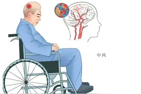 脑梗、脑出血后，身体会出现6大问题，该如何应对？一件事要做好图片