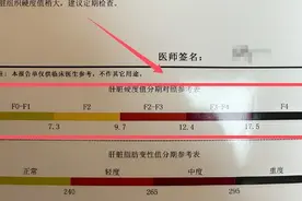 你的肝 “硬不硬”？肝弹检查记好这 4 个关键数字，非常简单！图片