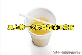 早上第一次尿有泡沫正常吗图片