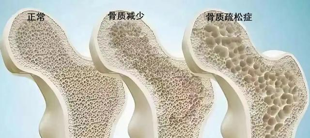 运动可能影响寿命！再三提醒：过了55岁，运动“五不要”得牢记