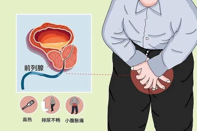 男人莫名其妙患上前列腺炎？研究发现：患前列腺炎，有这7大原因