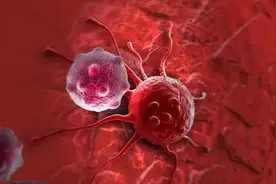 做了胰腺癌手术后，还能活几年？医生不再隐瞒，说出了实话图片