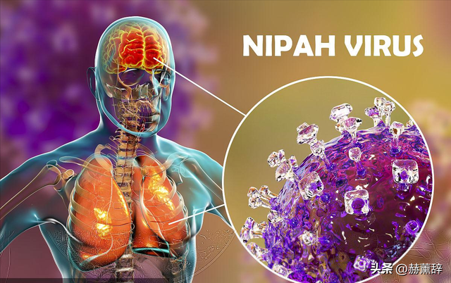 印度爆发尼帕病毒	，死亡率达75%，世界经不起折腾，中国也有病原