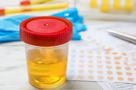 小便发黄，异味重？多是这两处出现问题了！教你两招，彻底改善图片