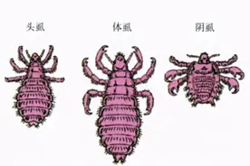 同人类共演化，解开人类“褪毛之谜”的虱子，现如今怎么消失了？图片