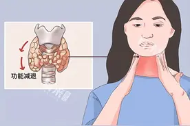 起床后身体有这5种表现，可能是甲状腺在求救，千万别大意！图片