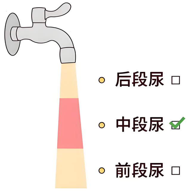尿常规检查，用晨起的第二泡尿，会不会影响检查结果？一文搞懂！