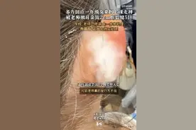 女童被老师揪耳朵撕裂2cm，校方已暂时停课，教育局回应图片