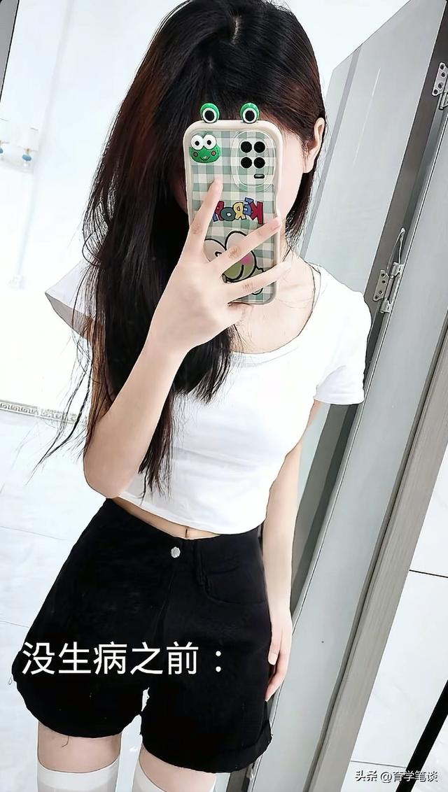 江西女幼师刘慧去世，仅21岁，娃娃脸很漂亮，身上莫名淤青后确诊