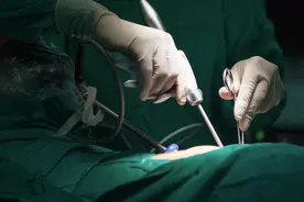 最“痛苦”手术排行榜被公布，占一个就算勇士！看看你经历过几个图片