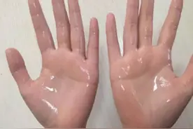 手心爱冒汗，不是热是身体在呼救！要想快速治好，每天练这个动作图片