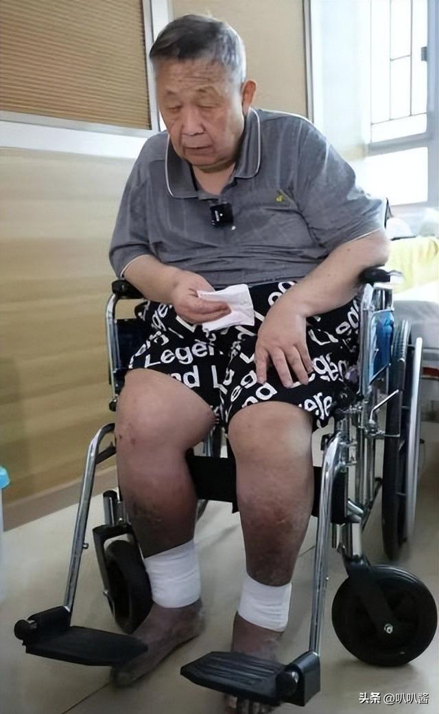 出名后出轨保姆，气死原配，如今77岁的他晚景凄凉，子女与其割席