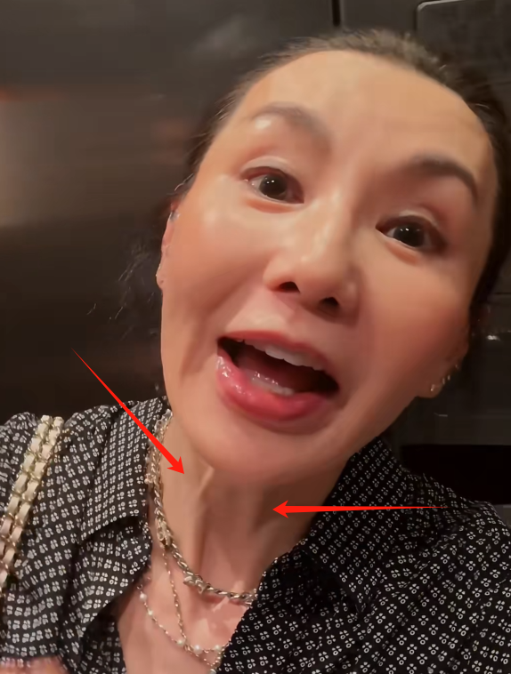 苹果肌肿胀，脸部馒化，60岁张曼玉近照曝光，不老女神滤镜稀碎