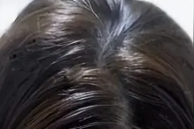 头发容易出油 如何强力控油图片