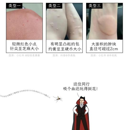 被蚊子咬后起红点vs鼓大包，说明体质有区别？