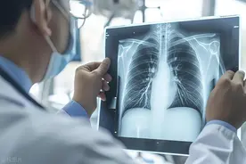 体检报告中的“钙化”到底是啥？是癌症吗？专家教你判断是敌是友图片