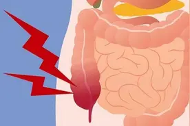 哪些情况影响吸收，让瘦人总是长不胖？想增肥的瘦子多了解！图片
