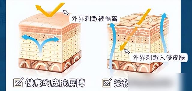 中年女人“运动前后”，再穿同一件衣服：差距好大，对比就懂了