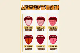 停下来看看：三分钟教你如何分辨宝宝的舌苔是否健康图片