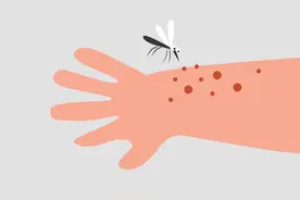 夏季户外活动常常被叮“一身包” 如何躲过虫咬皮炎？图片