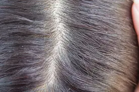 经常按摩头皮，原来有这么多好处！图片