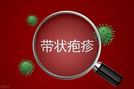 七种外治疗法治疗带状疱疹后遗神经痛图片