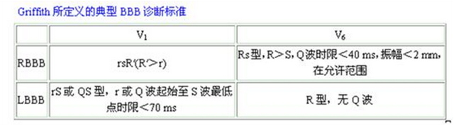 室性心动过速的体表心电图鉴别诊断