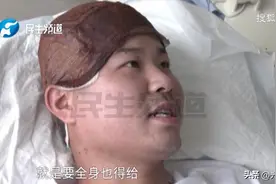 小伙瞒着父亲“割皮救父”，儿媳一番话让人震惊，如今结局如何?图片