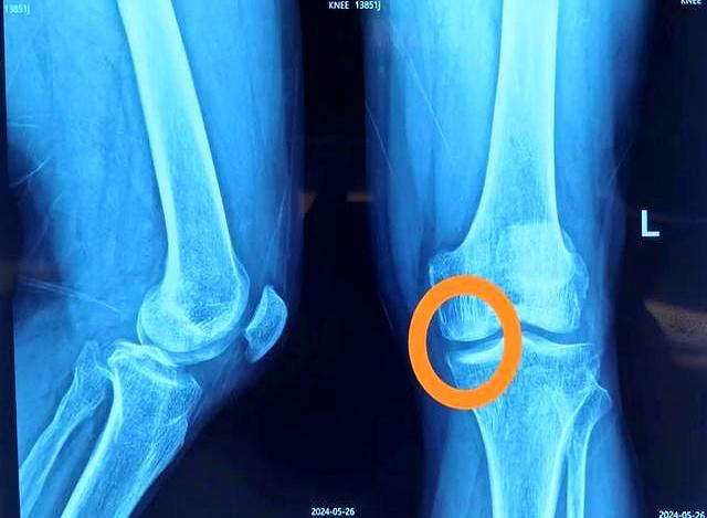 走路才是最有效运动？科学家：每天至少走4967步。尤其是老年人！