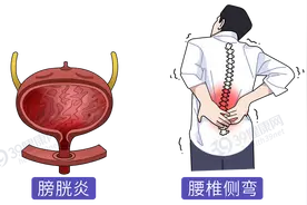 肾不好时，身上会出现“两黑一臭"！不想肾提前报废，做好这4件事图片