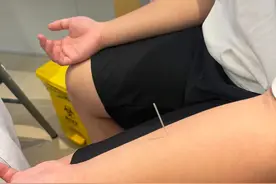 小儿学堂 | 听说小宝也可以针灸，见效还很快？各位家长了解下！图片