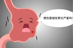 不外传的自救指南，萎缩性胃炎患者，坚持3个原则，逆转胃萎缩图片