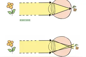 散光到底是个啥？赶快点进来看看~图片