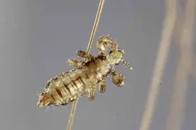 和人类共同演化几百万年的虱子, 是如何解开“人类穿衣之谜”的?图片