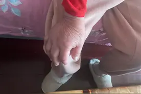 90岁母亲一到下午就说自己快不行了，手一直肿胀，揪心图片