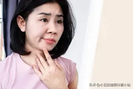 得了周围性面神经麻痹怎么办？科学服用4类药物，修复受损神经图片