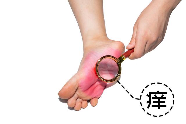 宝子快看！脚上鸡眼别发愁，根治妙招大集合
